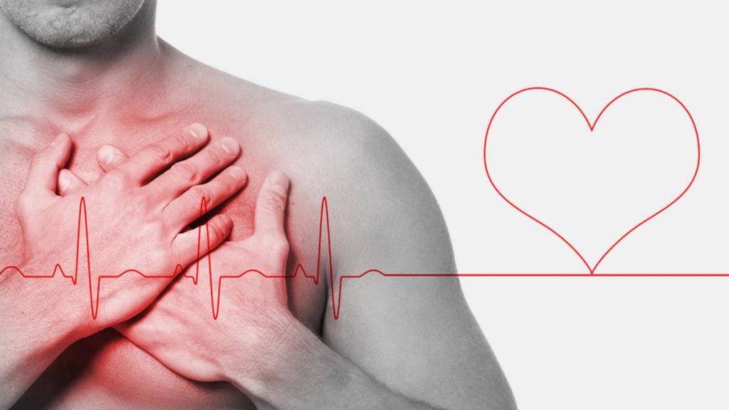 Síntomas del paro cardíaco